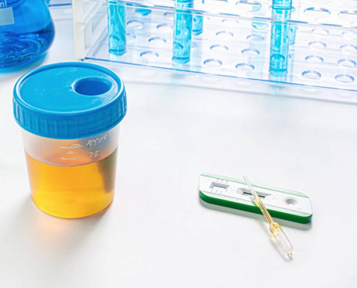 Synthetic Urine
